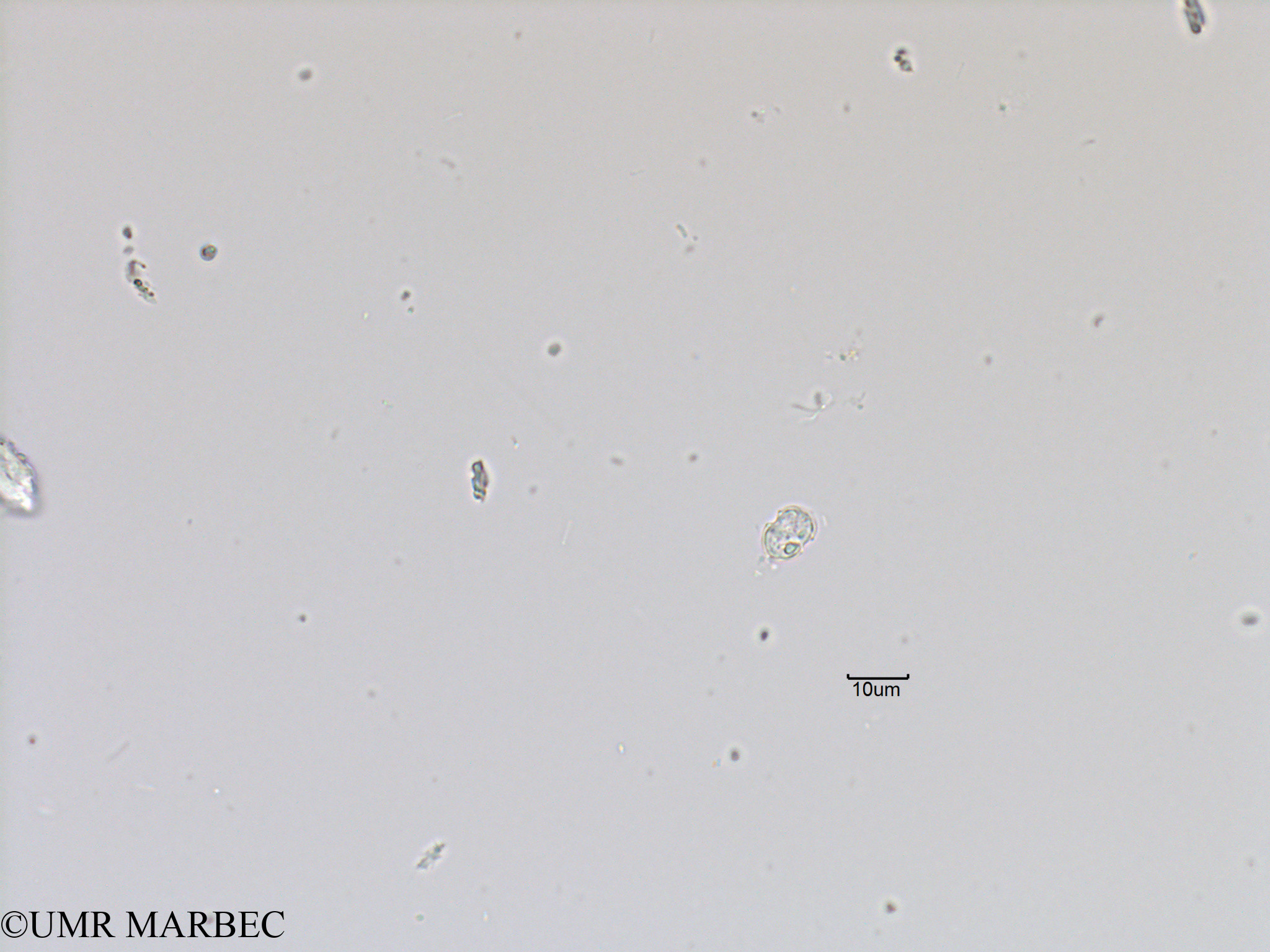 phyto/Bizerte/bizerte_bay/RISCO November 2015/Azadinium spp (Baie_T5-ACW1-Petit dino- cf heterocapsa minima ou azadinium-18).tif(copy).jpg